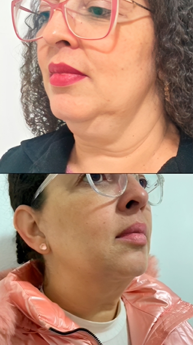 Captura-de-tela-2026-04-18-095443 (1)